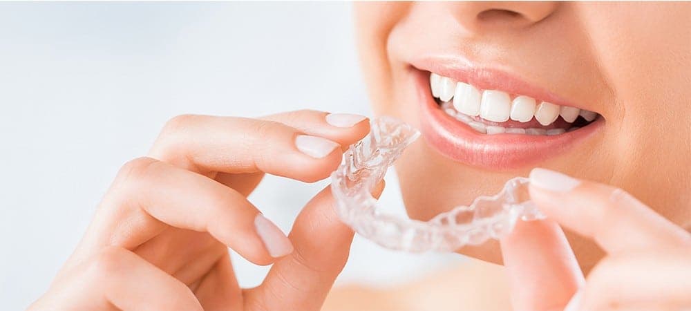 Invisalign